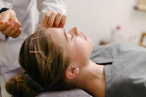 acupuntutre therapy