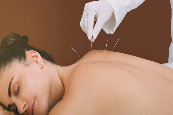 needle therapy