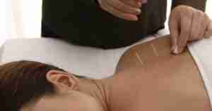 ear Acupuncture