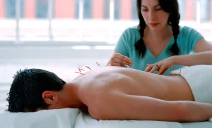 acupunture treatment