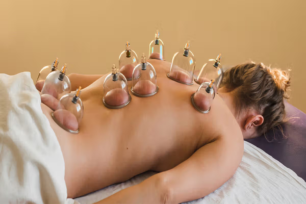 cupping therapy for lower back pain 