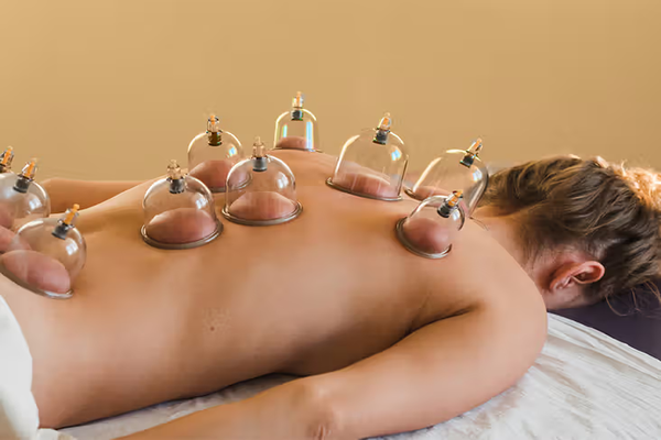 advantages of cupping therapy​ 