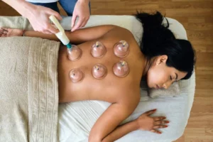 advantages of cupping therapy​