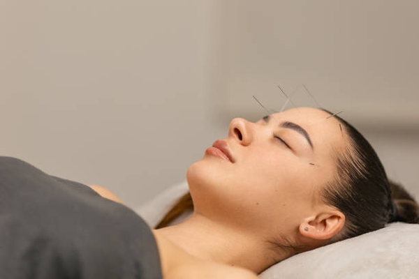 acupunture in delhi